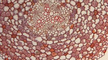 Cross section of white baneberry root showing vascular cylinder.