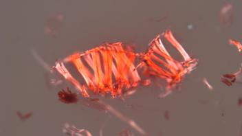 Cross section of Hakea leaf showing sclerenchyma and resin canals.