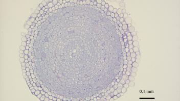 Cross section of sunflower root showing vascular arrangement.