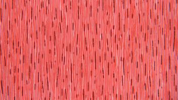 Tangential section of juniper showing vertical resin canals.