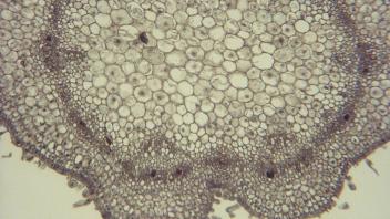 Bean stem cross section showing discrete vascular bundles.