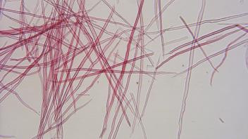 Dispersed pine wood fibers and tracheids from maceration preparation.