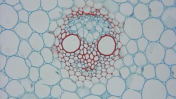 Enlarged view of stem vascular bundles and parenchyma.