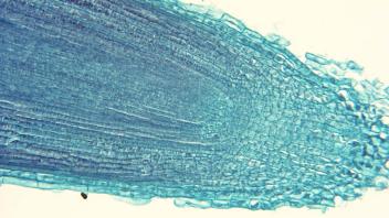 Bean root tip showing elongated cells in the elongation zone.