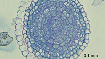 Longitudinal section of radish root tip showing meristem region.