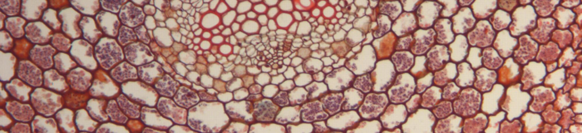 Cross section of white baneberry root showing vascular cylinder.